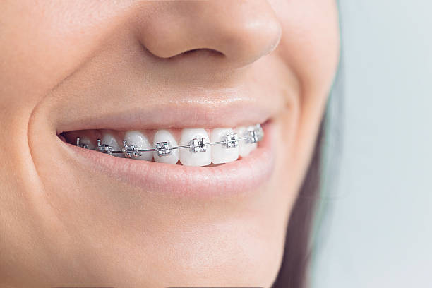 Dental X-Rays and Imaging in Sammamish, WA